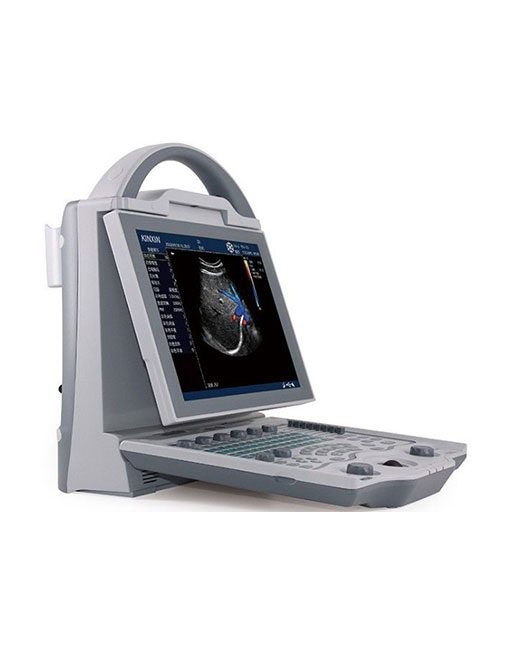 Portable Color Doppler US-D90