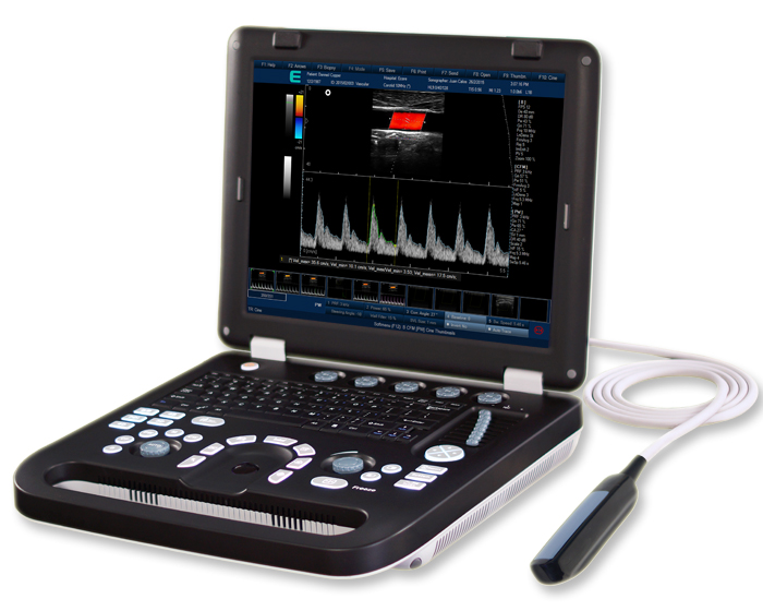 Laptop Color Doppler US-EC50C