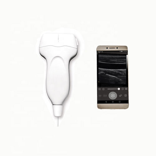 Smart Ultrasound US-UP20