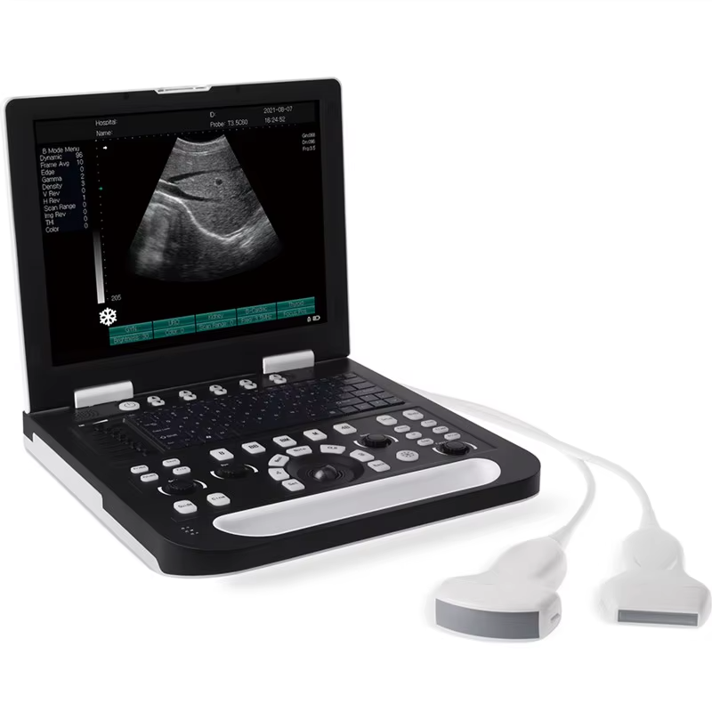 Full-digital Laptop Ultrasound Scanner US-CP01