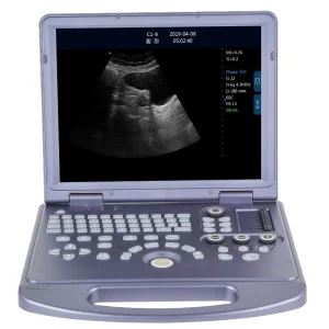 High-level B/W Ultrasound Scanner US-BW360