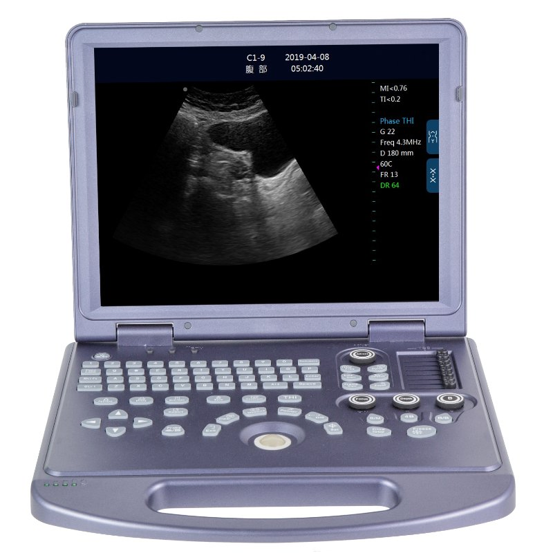 High-level B/W Ultrasound Scanner US-BW360