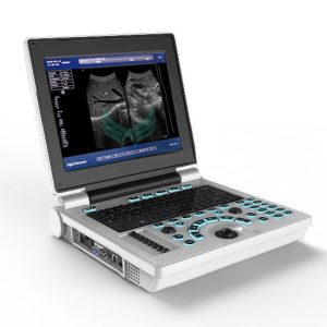 Color Doppler  US-D20