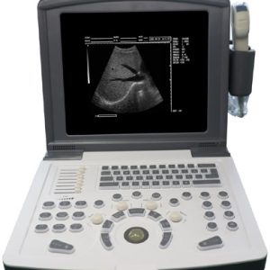 Full Digital Ultrasound Scanner US-B660