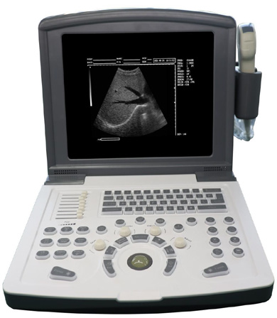 Full Digital Ultrasound Scanner US-B660