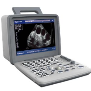 Ultrasound Scanner US-B300