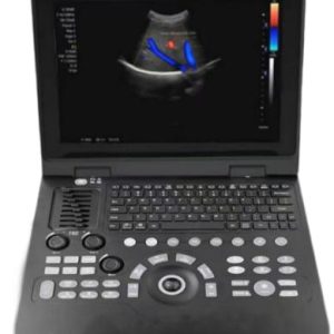 Full-digital Laptop Ultrasound Scanner US-BP30