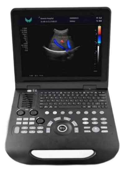 Full-digital Laptop Ultrasound Scanner US-BP30