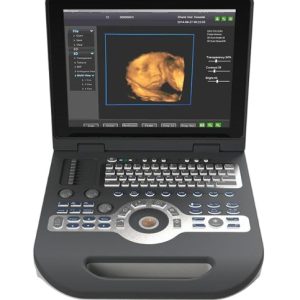 Laptop Color Doppler US-D3800