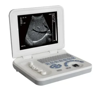 Notebook B/W Ultrasound US-B30
