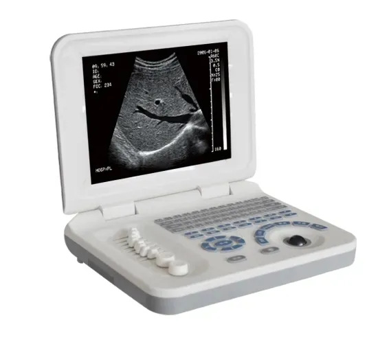 Notebook B/W Ultrasound US-B30