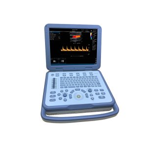 Laptop Color Doppler US-N30